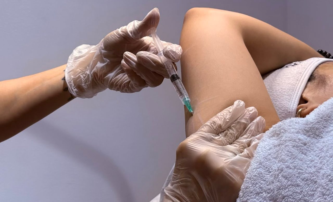 Botox treatment at D&B Medical Group