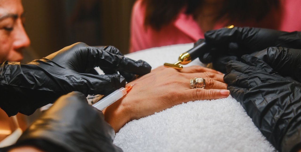 Hand rejuvenation treatment at D&B Medical Group